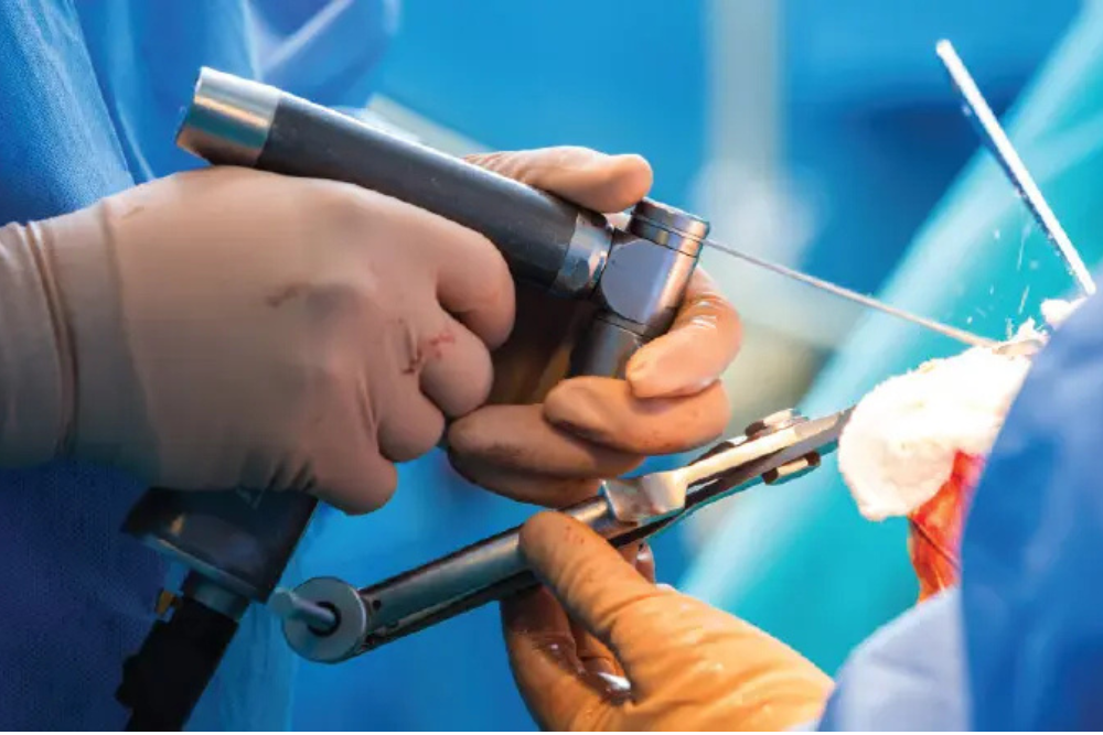 Ortho Procedure / Surgery