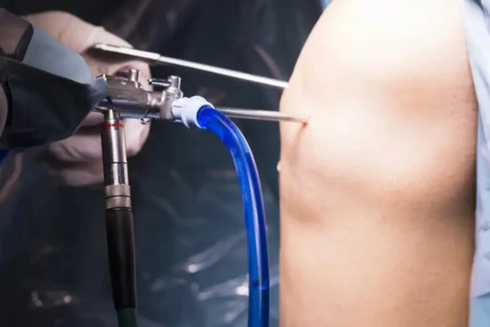 Preparation & Anesthesia