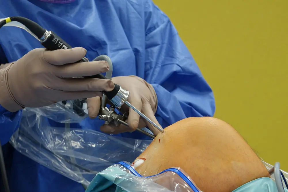 Arthroscopy surgery Step 2