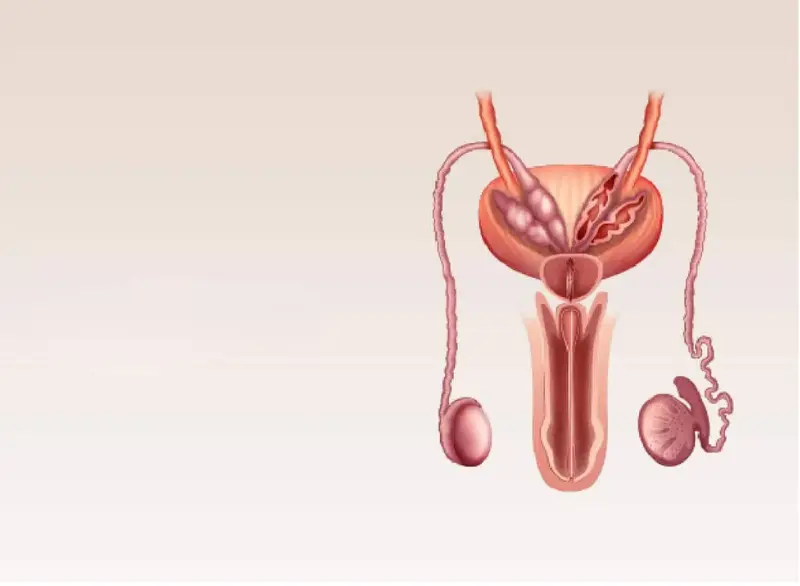 Varicocele Conclusion