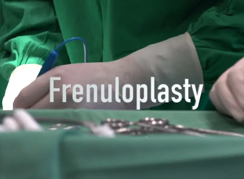Frenuloplasty surgery Step 4