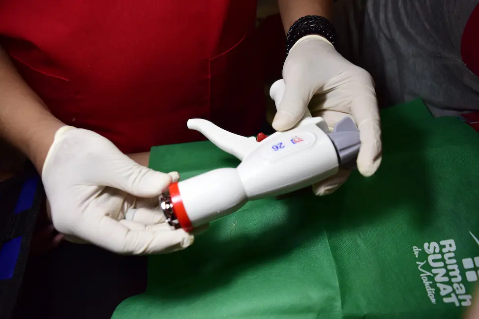 Stapler Circumcsion Feature