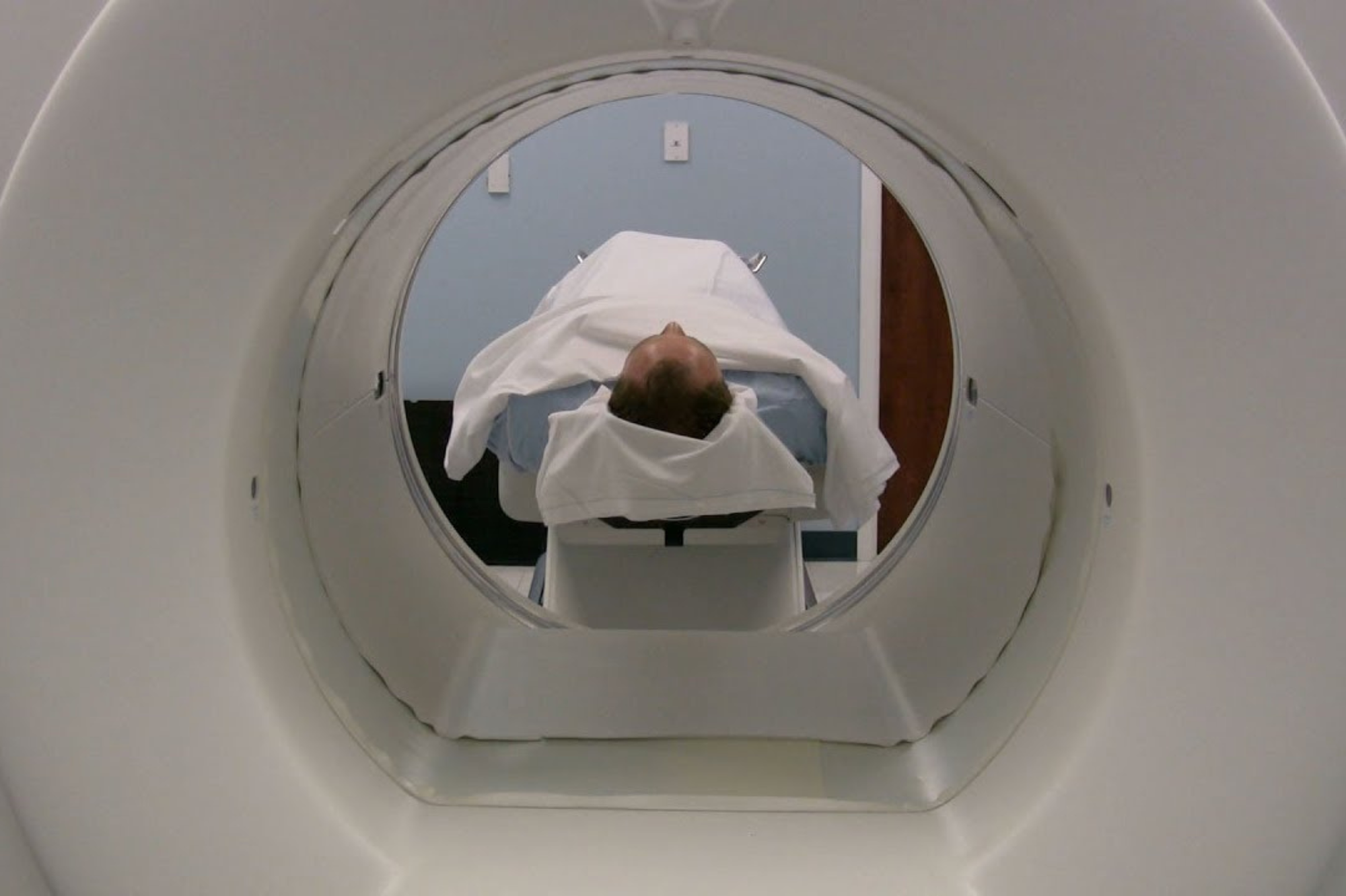 KidneyStone Cystolithotomy Step 1