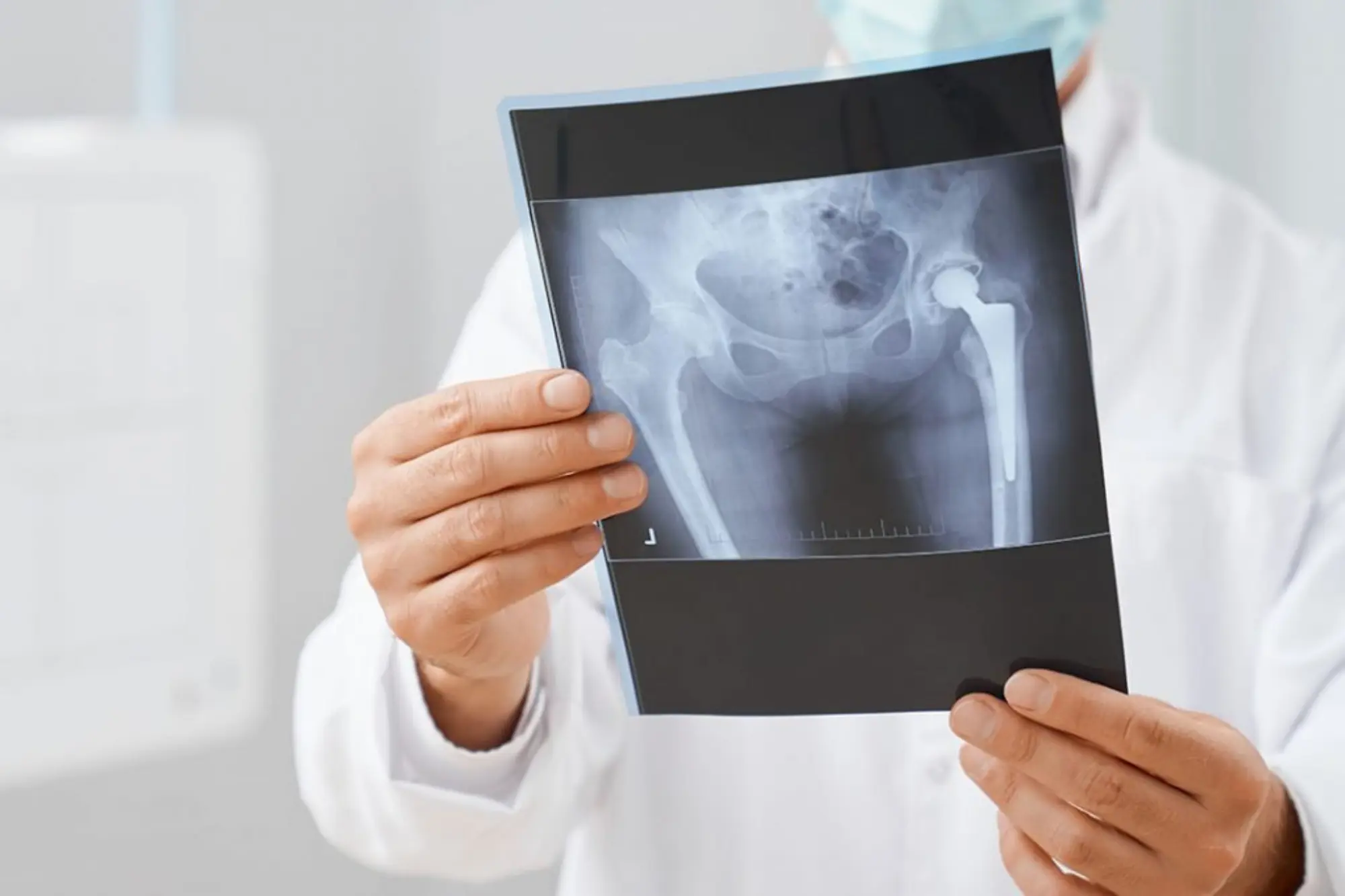 THR Unilateral Feature