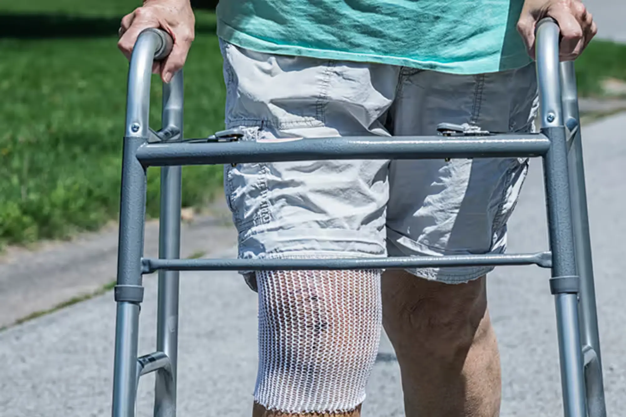 TKR Bilateral Step 4